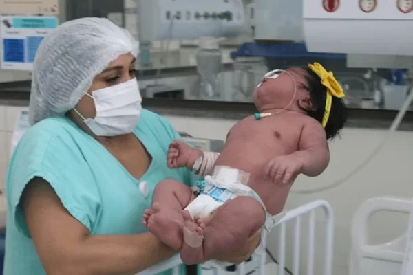 Imagem mostra mulher segurando um bebê de sete quilos - Metrópoles