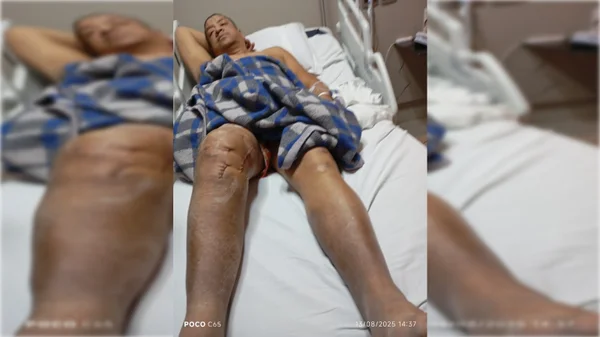 homem deitado em uma maca - Metópoles