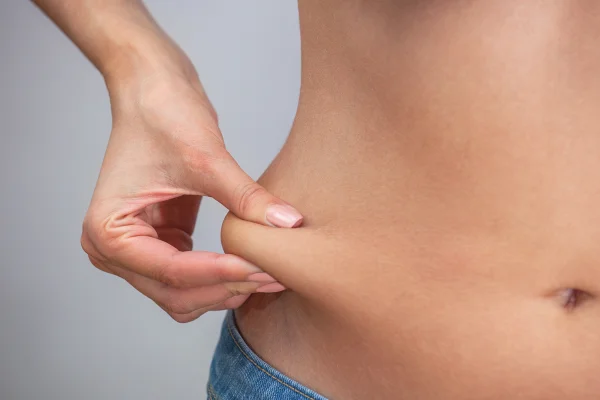 Foto colorida de mulher pegando na gordura localizada na barriga - Nutricionista explica o que é gordura visceral e por que é perigosa - Metrópoles
