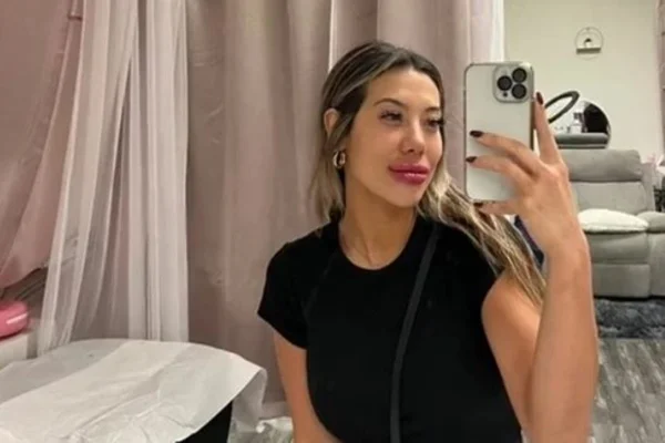 Foto colorida de uma jovem chamada Basia Query, que fez um preenchimento labial e foi parar no hospital