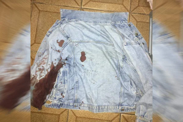 Homem baleado Metrô-DF