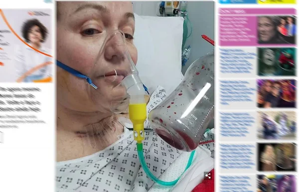 Britânica diz ter sido “salva” do câncer pela Covid-19