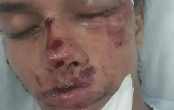 Fotografia colorida de influencer digital agredido durante assalto