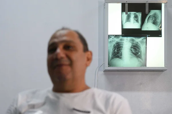 Foto colorida do paciente Antonio Rodrigues, que tem a doença paracoccidioidomicose - Metrópoles