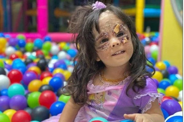 Luna após sete procedimentos