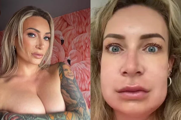 Na imagem, duas fotos de uma mulher loira - Metrópoles