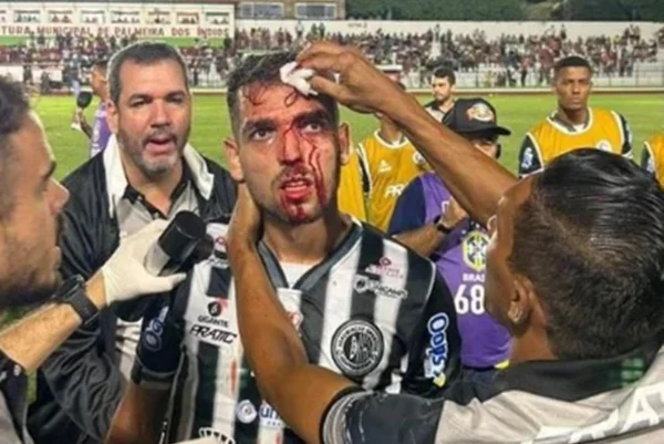 Imagem de Allef com a cabeça ferida - Metrópoles