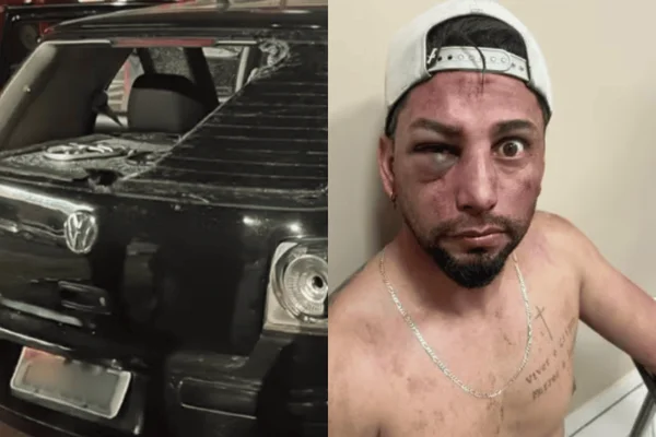 Imagem colorida de um homem branco sem camiseta e cheio de hematomas - Metrópoles