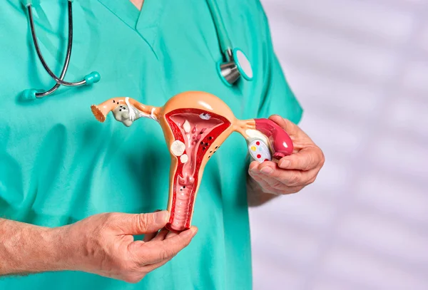 Imagem colorida de médico segurando escultura que imita um sistema reprodutivo feminino para falar sobre câncer - Metrópoles