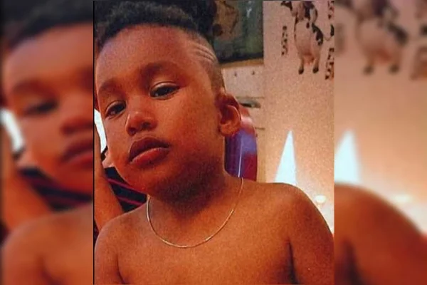 Menino morre queimado após tia incendiar carrapatos em pote com álcool