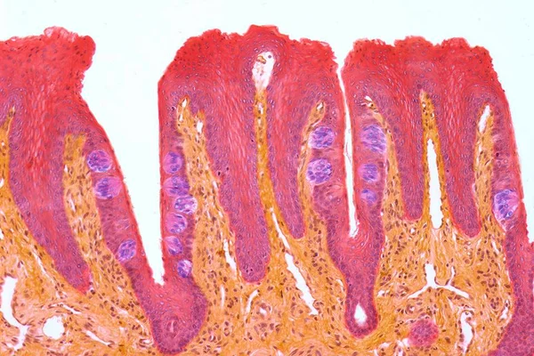 Imagem mostra papilas gustativas em close - Metrópoles