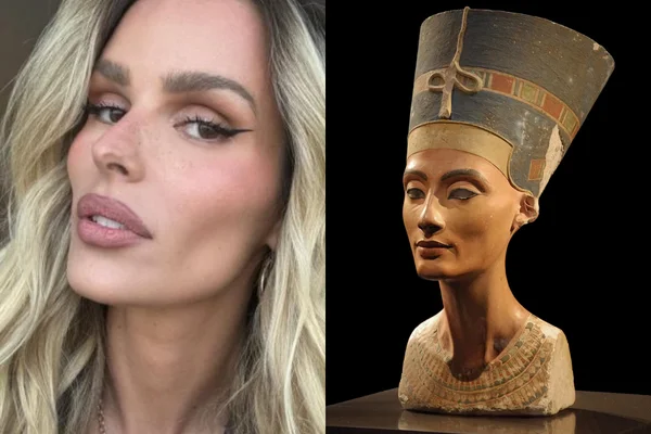 Botox no pescoço melhora o contorno facial e reduz sinais da idade