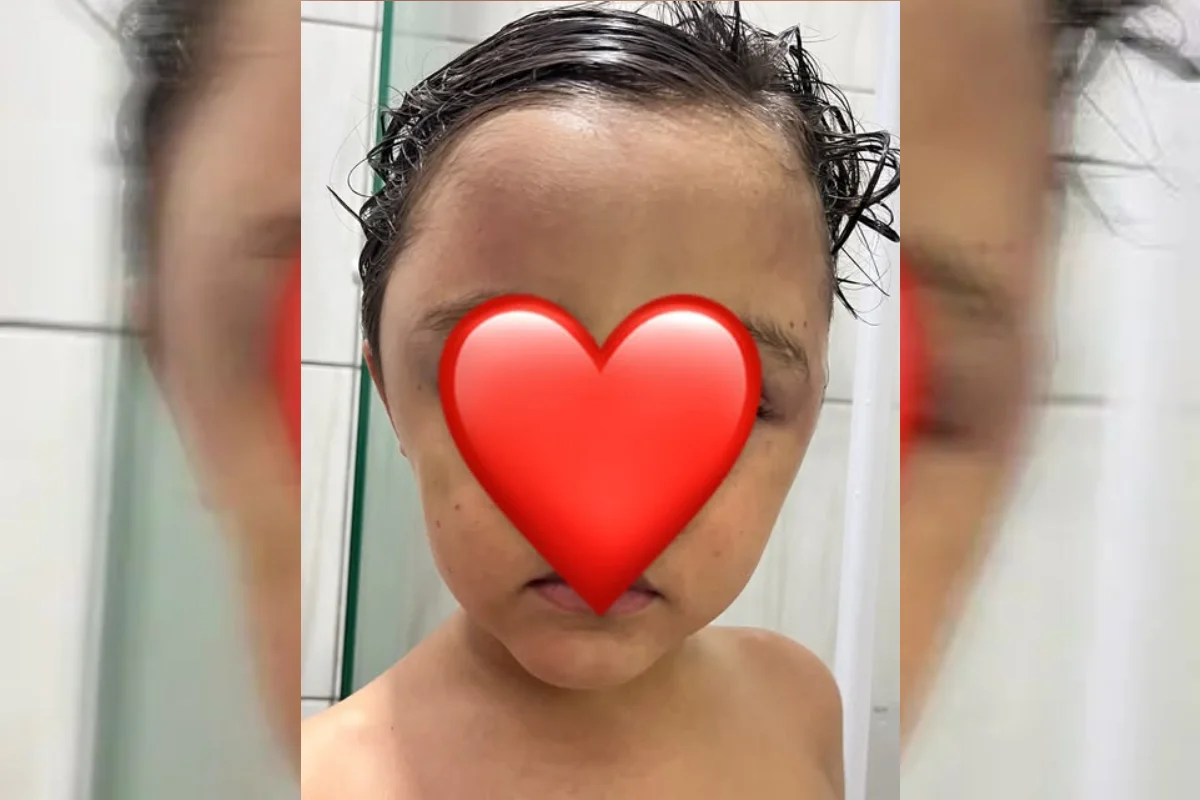 menino com olhos roxos menino com olhos roxos