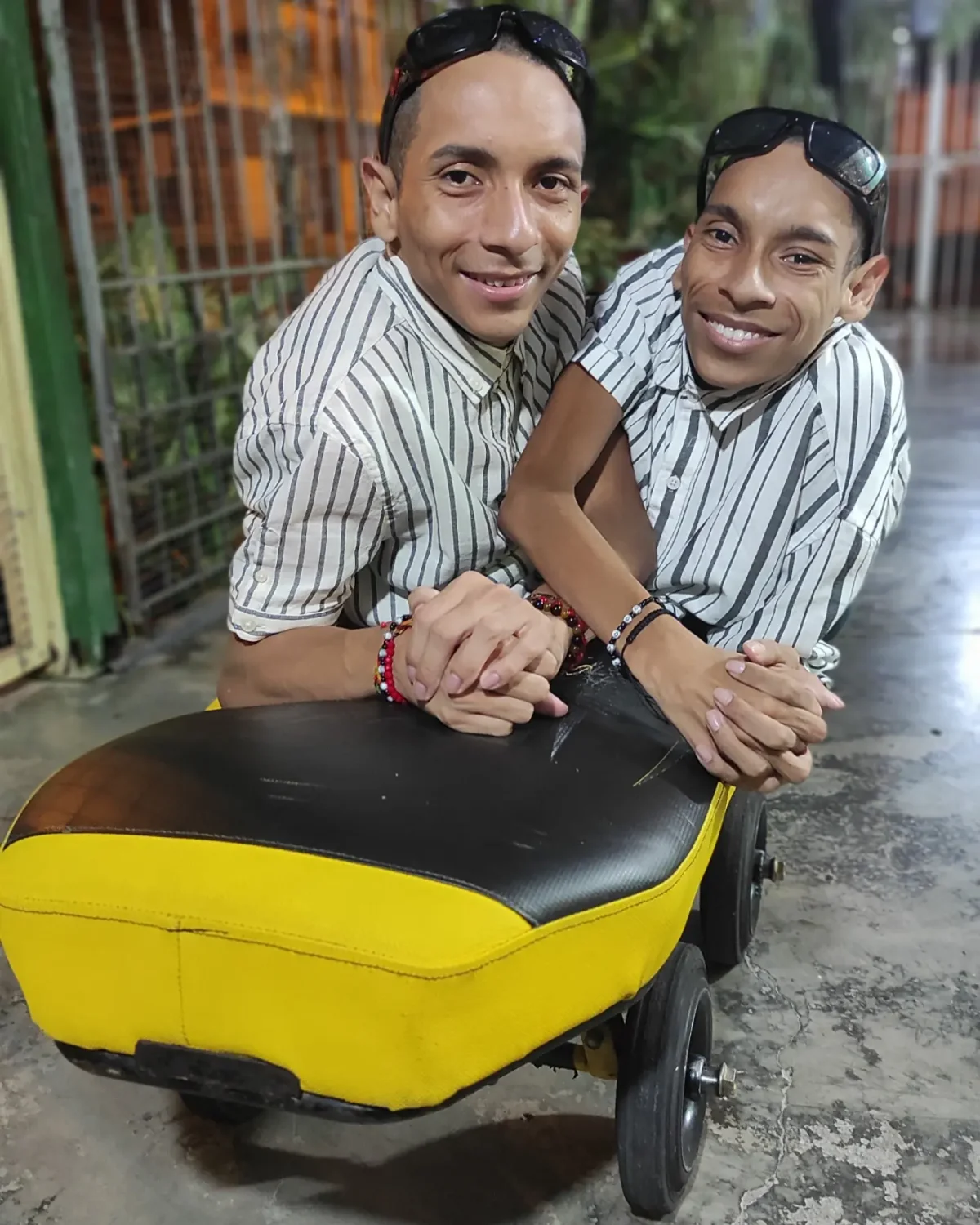 Gêmeos siameses do Equador morrem aos 27 anos na Colômbia - imagem 2 Gêmeos siameses do Equador morrem aos 27 anos na Colômbia - imagem 2