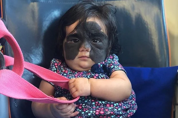 Brasiliense busca ajuda para pagar cirurgia da filha na Rússia