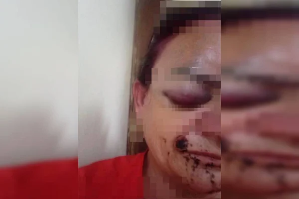 Ataque cruel: homem é preso após agredir e socar rosto de mulher no DF