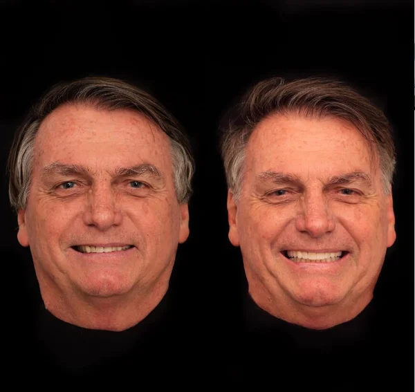 Montagem faz comparação de mudanças no rosto de Bolsonaro após harmonização facial
