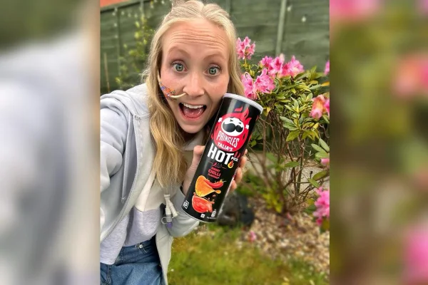 Foto de mulher com condição rara segurando uma batata chips - Metrópoles
