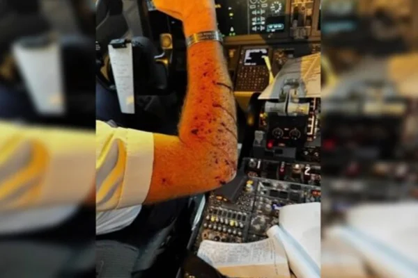 Imagem colorida de braço machucado