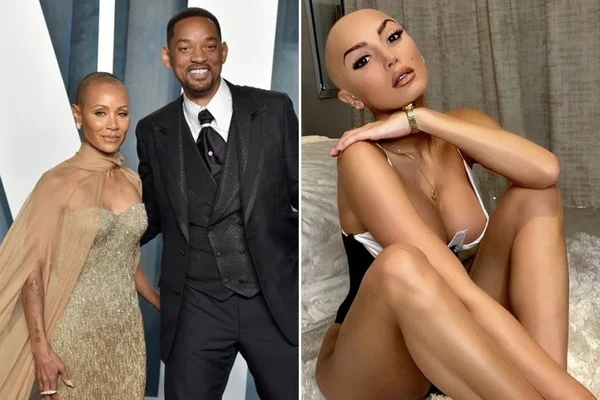 Modelo com doença de Jada defende Will Smith por agressão no Oscar