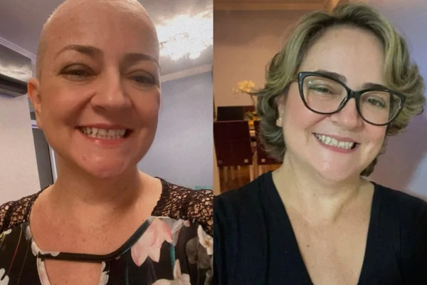 Fotos de Ana Prado durante a quimio, tratando o câncer de ovário, e a direita, Ana já com o cabelo maior após o tratamento. Metrópoles