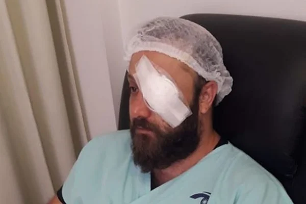 Homem recebe transplante de córnea e viraliza com post emocionado