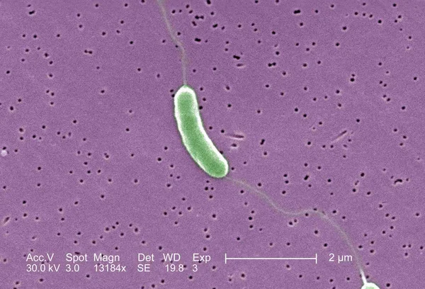 imagem colorida de Bacteria Vibrio vulnificus no microscópio