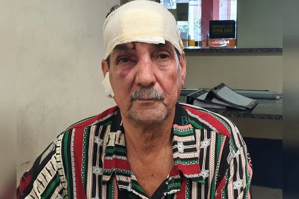 RJ: “Fico triste que ele foi liberado”, diz motorista sobre agressor