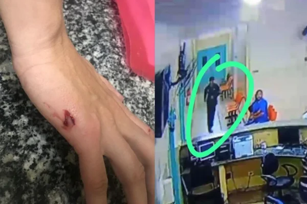 Mão machucada e imagens da câmera de segurança