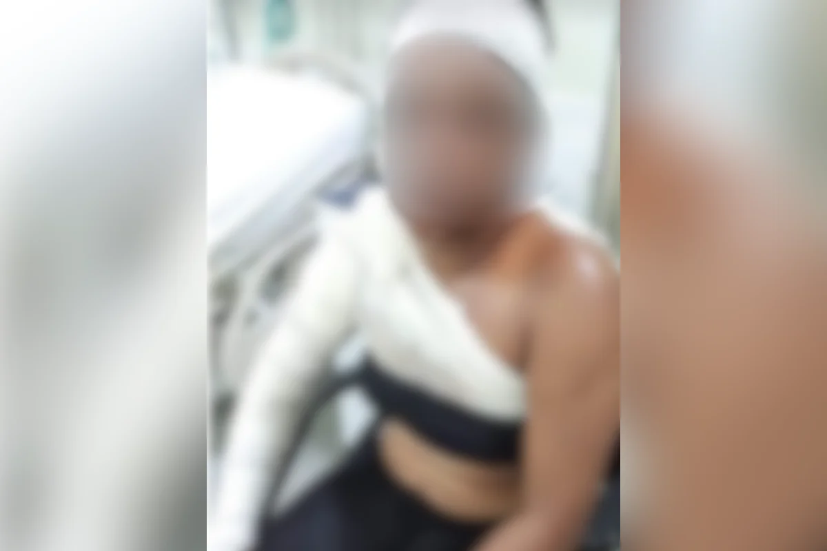 Ex-ajudante de cozinha queimou 36% do corpo Ex-ajudante de cozinha queimou 36% do corpo