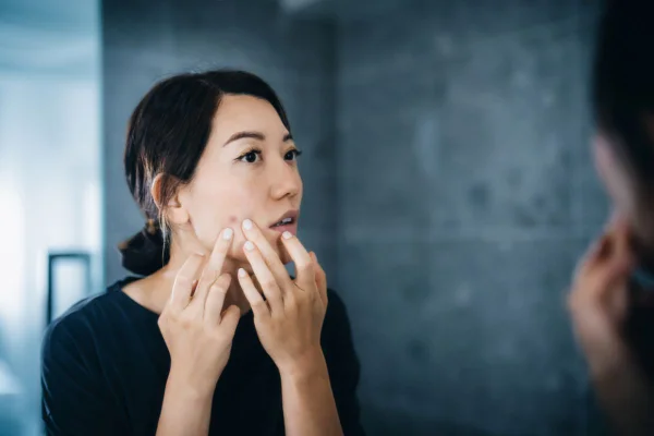 Acne após os 40: entenda a relação entre o metabolismo e a pele madura