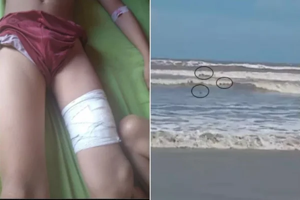Cardume de tubarões é visto em local onde menino de 11 anos foi atacado