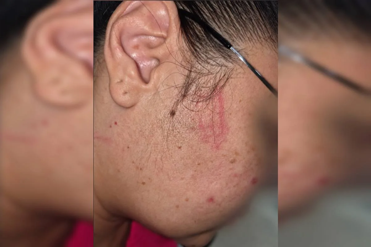 A profissional de saúde foi atacada por uma paciente