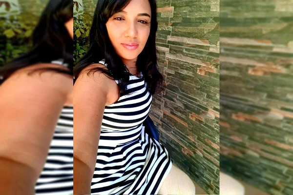 Mulher sentada com as duas pernas amputadas