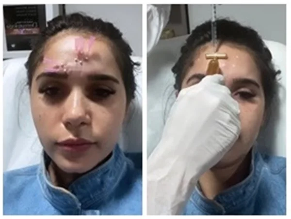 Gizelly Bicalho faz procedimentos estéticos