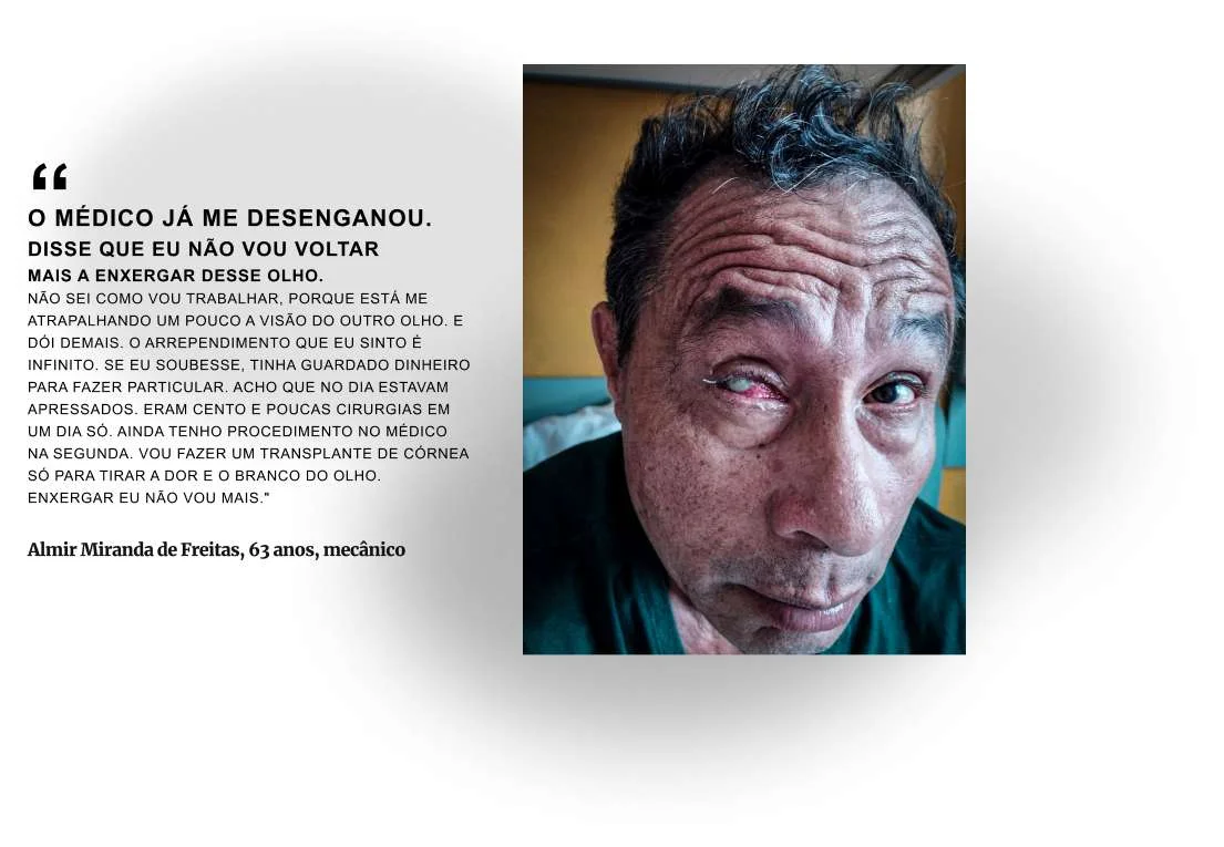 Após esta entrevista, Alair teve que retirar o olho para conter a infecção Após esta entrevista, Alair teve que retirar o olho para conter a infecção