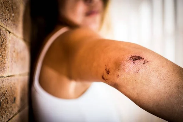Desembargador solta personal trainer que espancou ex-namorada