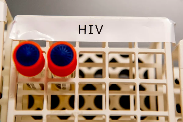 Teste HIV