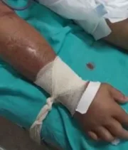 Dados apontam que antes da pandemia, os hospitais do Amazonas consumiam 800 ampolas Dados apontam que antes da pandemia, os hospitais do Amazonas consumiam 800 ampolas