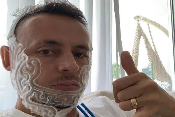 Saiba mais sobre máscara que Rafinha deve usar após cirurgia