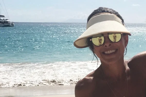 Como venci o melasma: dicas de quem há anos vive com manchas no rosto