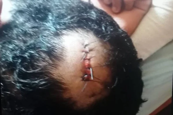Preso traficante que deu paulada na cabeça de morador da Asa Sul