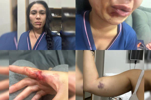 Juiz diz que mulher esganada não sofreu tentativa de feminicídio, “apenas” violência doméstica