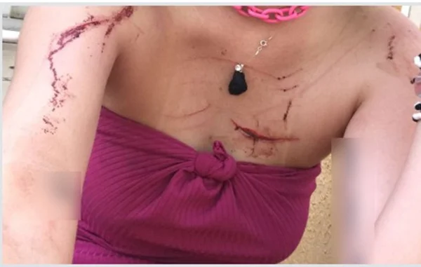 Jogador de clube da Série A é acusado de agredir dançarina em motel