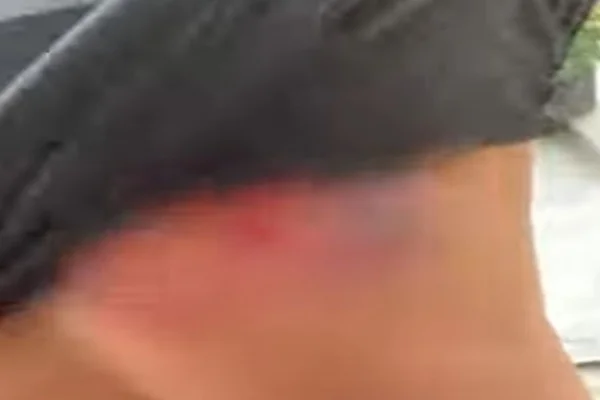 “Abençoado”: policial mostra colete furado após ser atingido por tiro no RJ