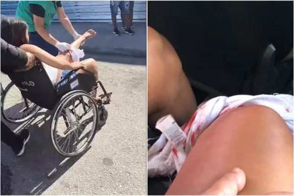 Imagem colorida, Grávida é baleada durante tiroteio e passa por parto de urgência no RJ - Metrópoles