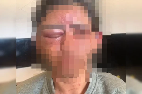 Homem drogado invade casa, estrangula mulher com toalha e é preso