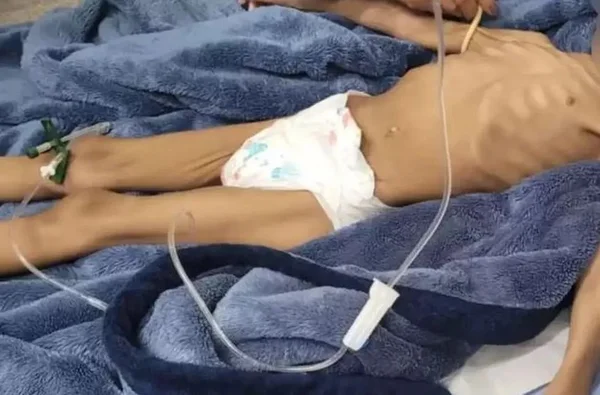 criança resgatada apos 40 dias sem comer