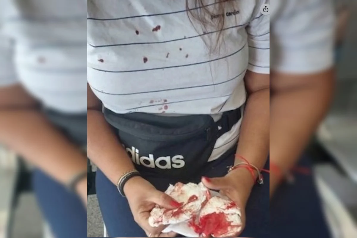 Mulher agredida e amaeaçada Mulher agredida e amaeaçada