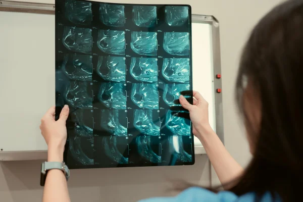 Foto colorida de médica segurando raio x- Metrópoles.